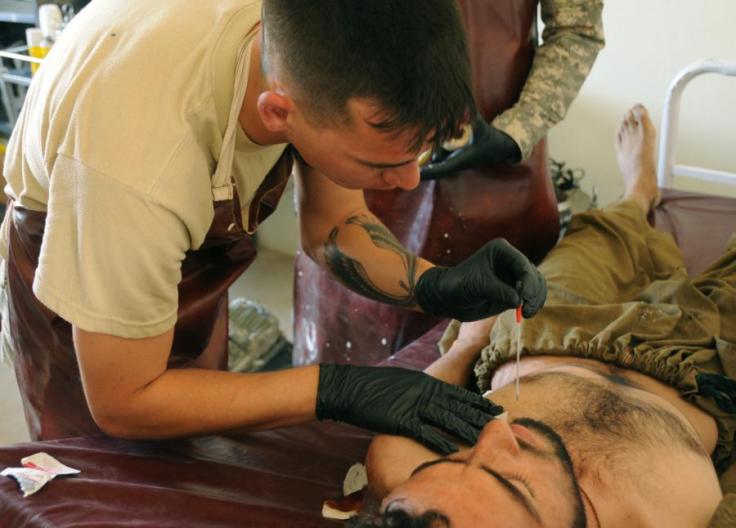 Needle-Decompression