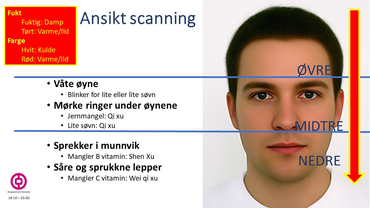 Seniorakupunktur 2 TRD 2018 3